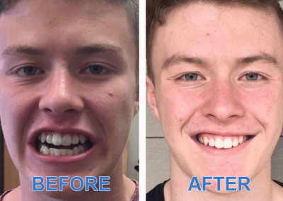 Before and After Images