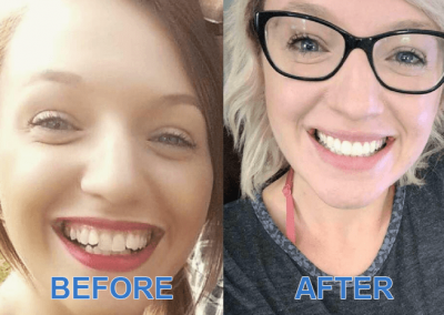 Before and After Images