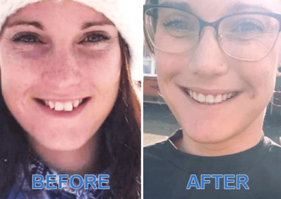 Before and After Images