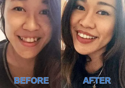 Before and After Images