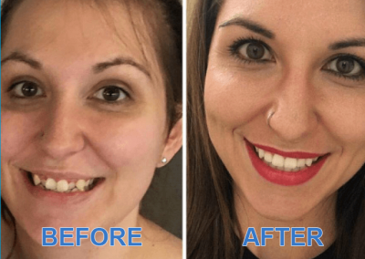 Before and After Images