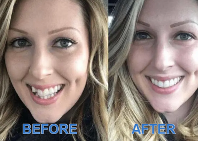 Before and After Images