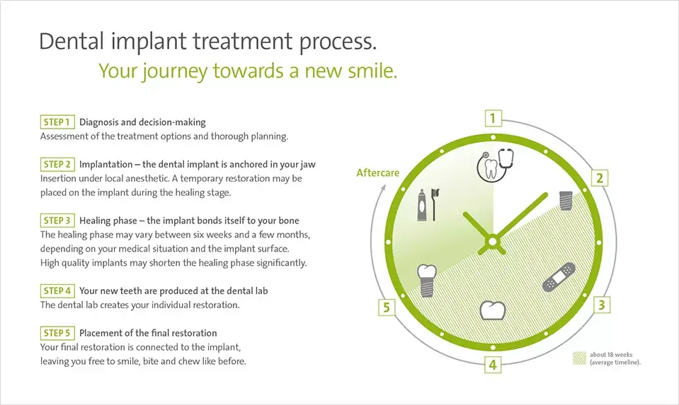 Dental implant treatment process. Your journey towards a new smile