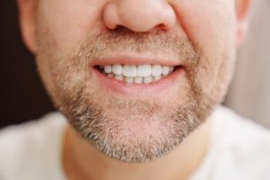Sydney Dental Implants 