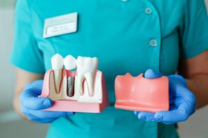 implant dentist abroad burwood