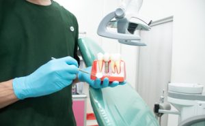 out of the country dental implants burwood