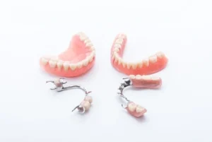 Can Dentures Be Fitted to Receding Gums types