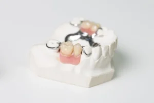 How Long Do Dentures Take to Make partial