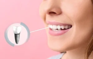 how to relieve pain from dental implant looks