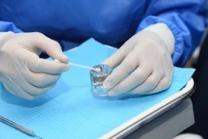 dentist preparing the sealant